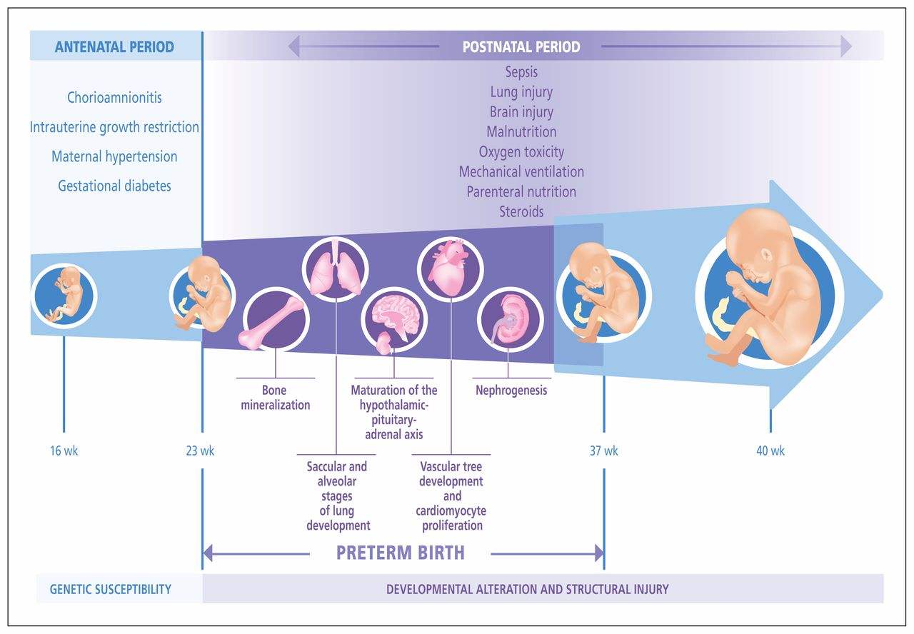 Preterm Birth