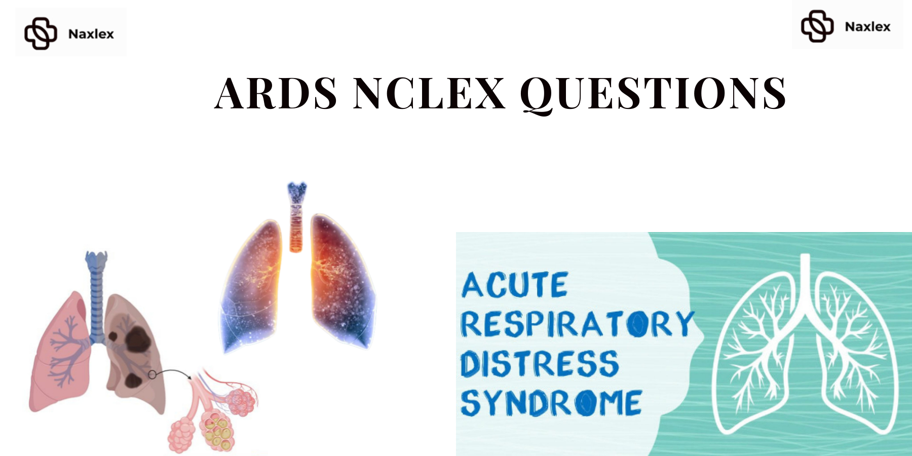 ARDS-NCLEX-Questions