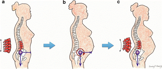 Musculoskeletal changes in Pregnancy