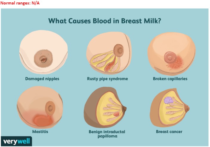 Causes of Blood in Breast Milk