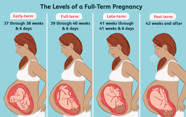 Post Term Birth