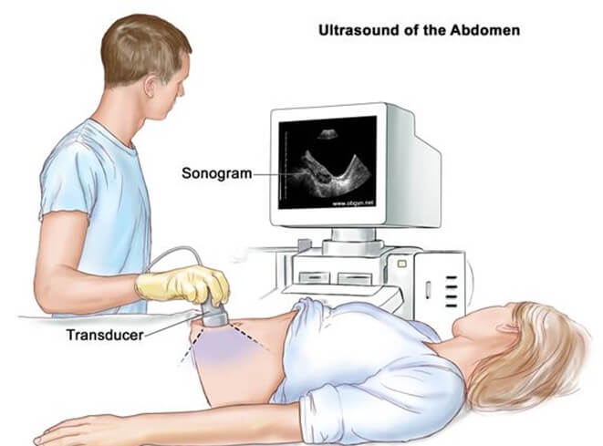 Ultrasound